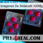 Imágenes De Sildenafil 100Mg 14
